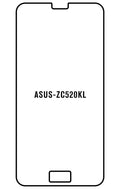 Film hydrogel Asus Zenfone 4 Max ZC520KL