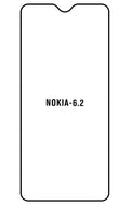 Film hydrogel Nokia 6.2/6 2019