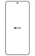 Film hydrogel Xiaomi 11i 2021