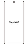 Film hydrogel Xiaomi 11T