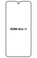 Film hydrogel Redmi Note 11 5G (China)