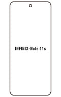 Film hydrogel Infinix Note 11s