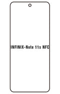 Film hydrogel Infinix Note 11s NFC