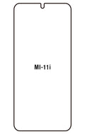Film hydrogel Xiaomi 11i / 11i HyperCharge (2022)