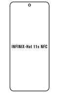Film hydrogel Infinix Hot 11s NFC