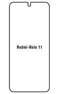 Film hydrogel Redmi Note 11(GLOBAL)