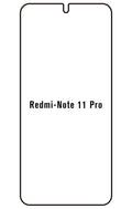 Film hydrogel Redmi Note 11 Pro 5G(GLOBAL)