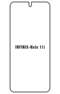 Film hydrogel Infinix Note 11i