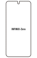 Film hydrogel Infinix Zero 5G