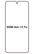 Film hydrogel Redmi Note 11E Pro