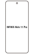 Film hydrogel Infinix Note 11 Pro
