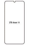 Film hydrogel ZTE Axon 11 5G (A2021)