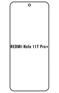 Film hydrogel Redmi Note 11T Pro+