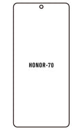 Film hydrogel Honor 70