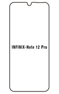 Film hydrogel Infinix Note 12 Pro 4G