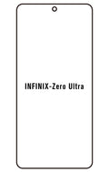 Film hydrogel Infinix Zero Ultra