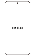 Film hydrogel Honor 80