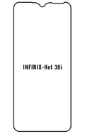 Film hydrogel Infinix Hot 30i
