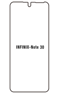 Film hydrogel Infinix Note 30