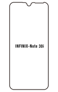 Film hydrogel Infinix Note 30i