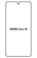 Film hydrogel Infinix Zero 30 5G