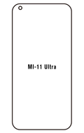 Film hydrogel Xiaomi 11 Ultra