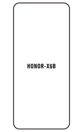 Film hydrogel Honor X6B 5G (6.77'')