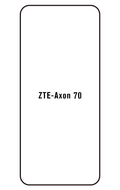 Film hydrogel ZTE Axon 70