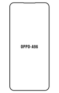 Film hydrogel Oppo A96(overseas)