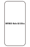 Film hydrogel Infinix Note 60 Ultra