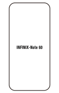 Film hydrogel Infinix Note 60