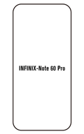 Film hydrogel Infinix Note 60 Pro 5G