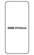 Film hydrogel Honor X70 Refresh Edition