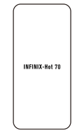 Film hydrogel Infinix Hot 70
