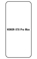 Film hydrogel Honor X70 Pro Max