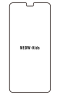 Film hydrogel NEOW Kids