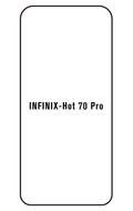 Film hydrogel Infinix Hot 70 Pro 5G